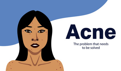 Similar image 21714558