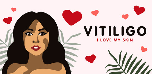 Similar image 21714560