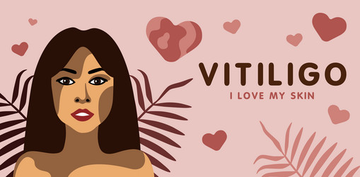 Similar image 21714565