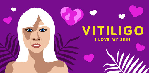 Similar image 21714566