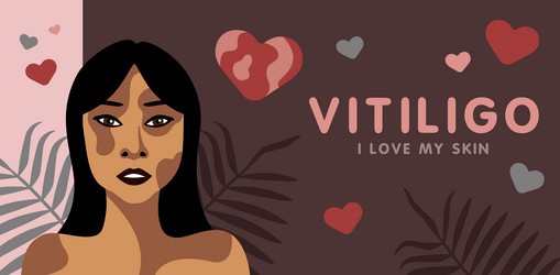 Similar image 21714593