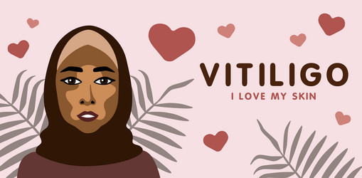 Similar image 21714598