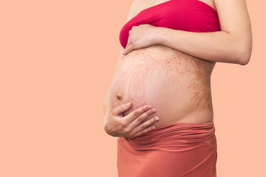 Similar image 21757334