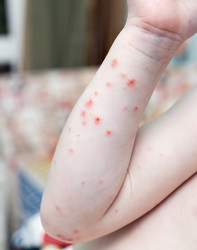 Similar image 21782086