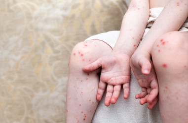 Similar image 21783425