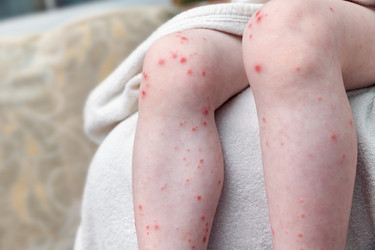 Similar image 21782097