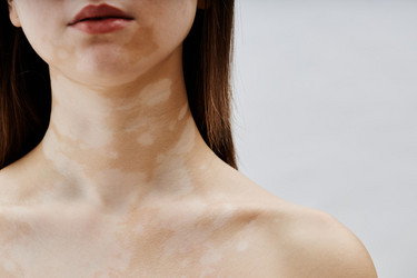 Similar image 22000065