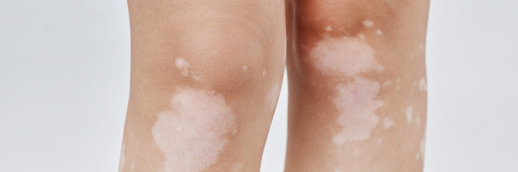 Similar image 22000062