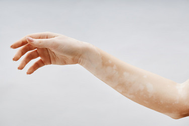 Similar image 22000123