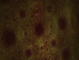 Similar image 22011169