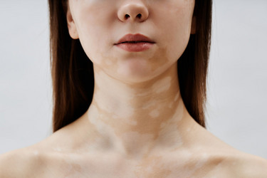 Similar image 22000064