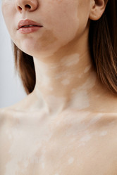 Similar image 22000070