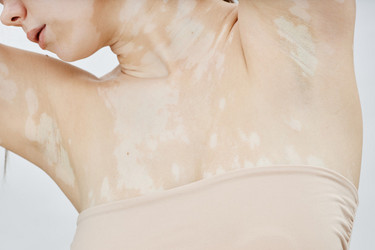 Similar image 22000098