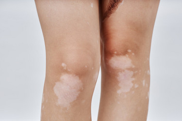 Similar image 22000086