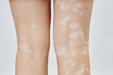 Similar image 22000097