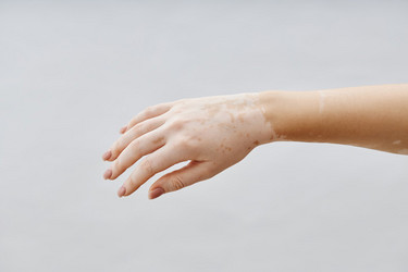 Similar image 22000136