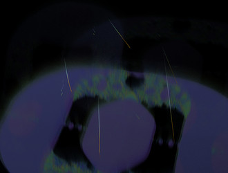 Similar image 22023797