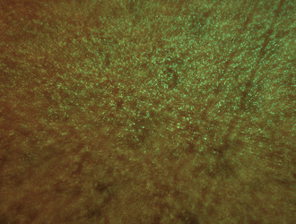 Similar image 22021325