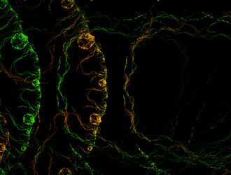 Similar image 22019955