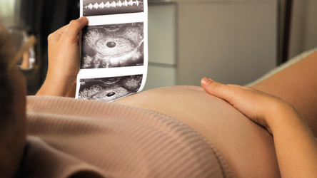 Similar image 22042708