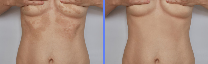 Similar image 22051189