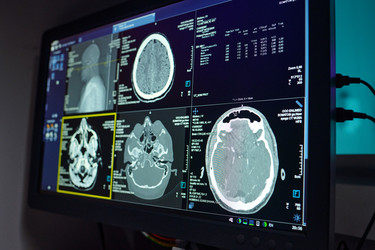 Similar image 22103340