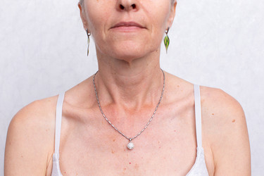 Similar image 22180013