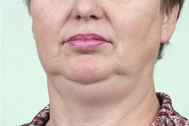 Similar image 22204153