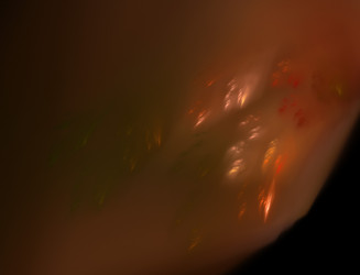 Similar image 22286165