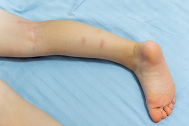 Similar image 22256479