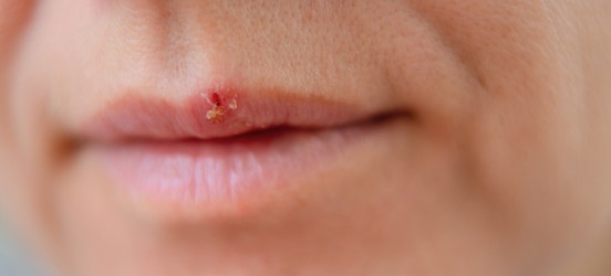 Similar image 22292650