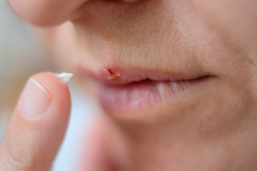 Similar image 22292651