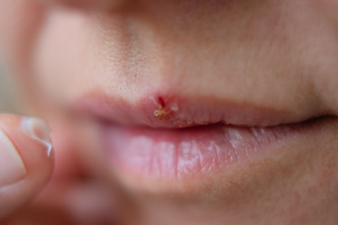 Similar image 22292681