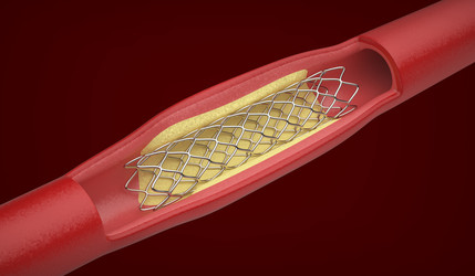 Similar image 22322653