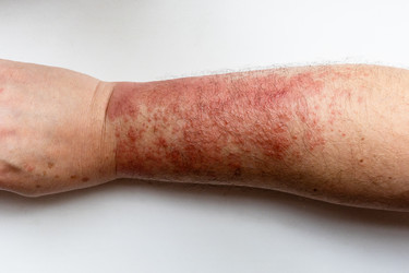 Similar image 22324061