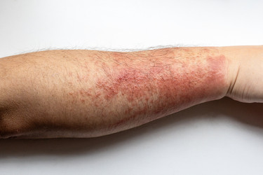 Similar image 22324194