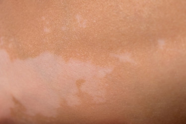 Similar image 22347416