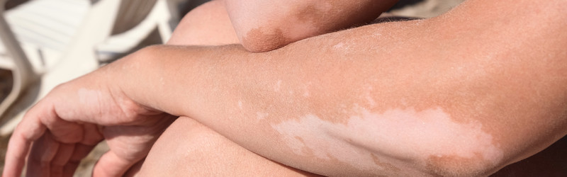 Similar image 22347419