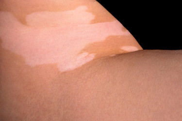 Similar image 22347436