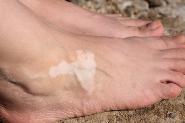 Similar image 22347440