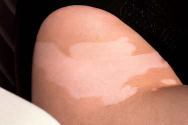 Similar image 22347442