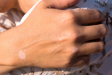 Similar image 22347448