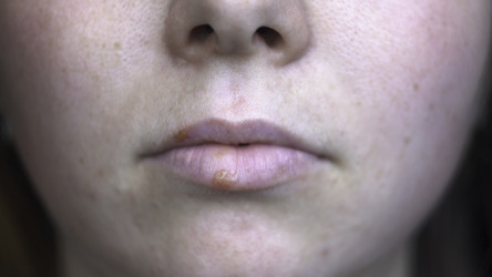 Similar image 22371377