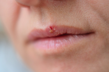 Similar image 22354377