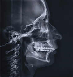 Similar image 22362593