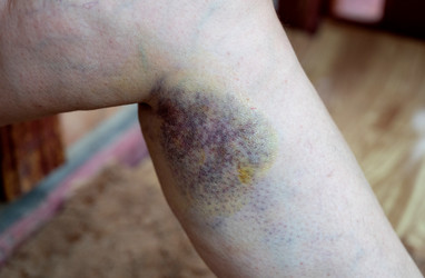 Similar image 22372939