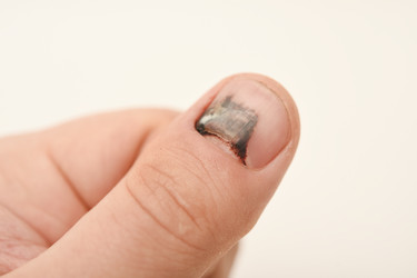 Similar image 22363702