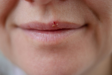 Similar image 22425349