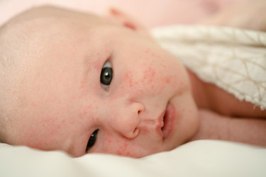 Similar image 22425386