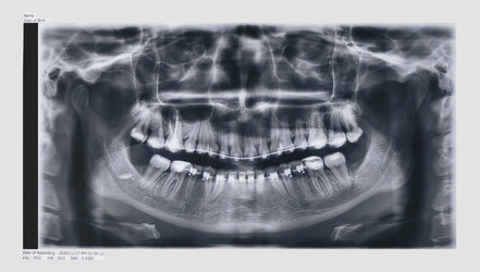 Similar image 22419252